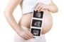 Third Trimester of Pregnancy: Health
