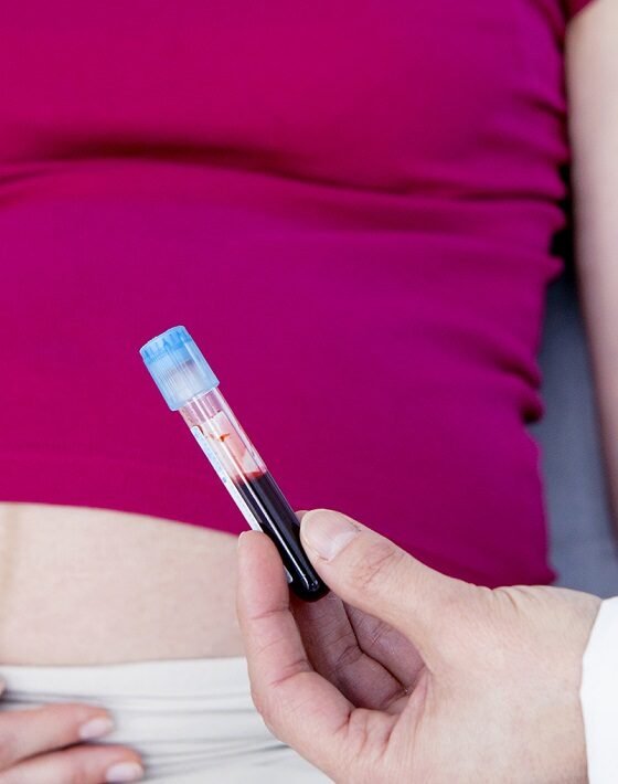 The Second Trimester of Pregnancy: Screening Tests